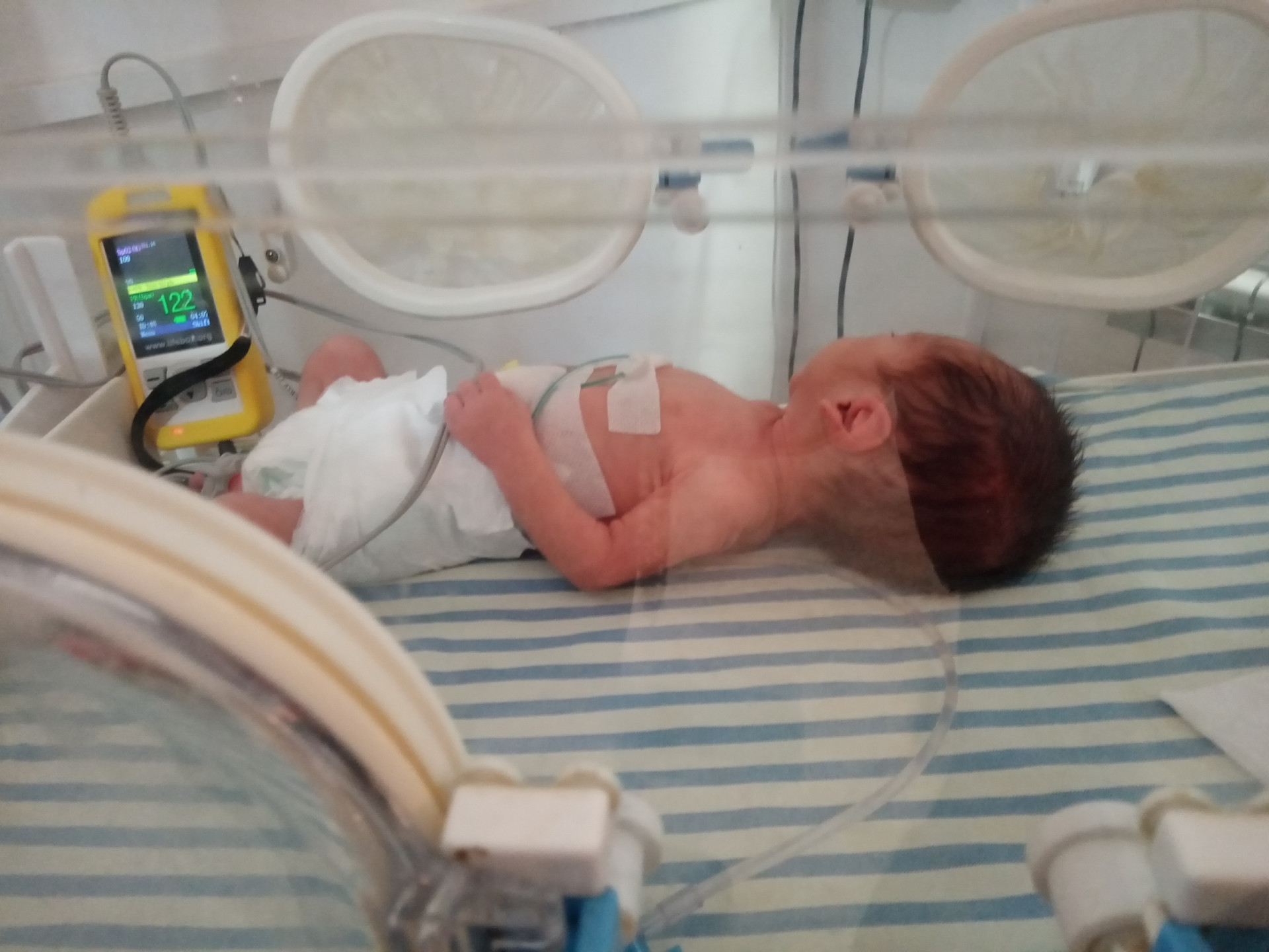 He was born sick