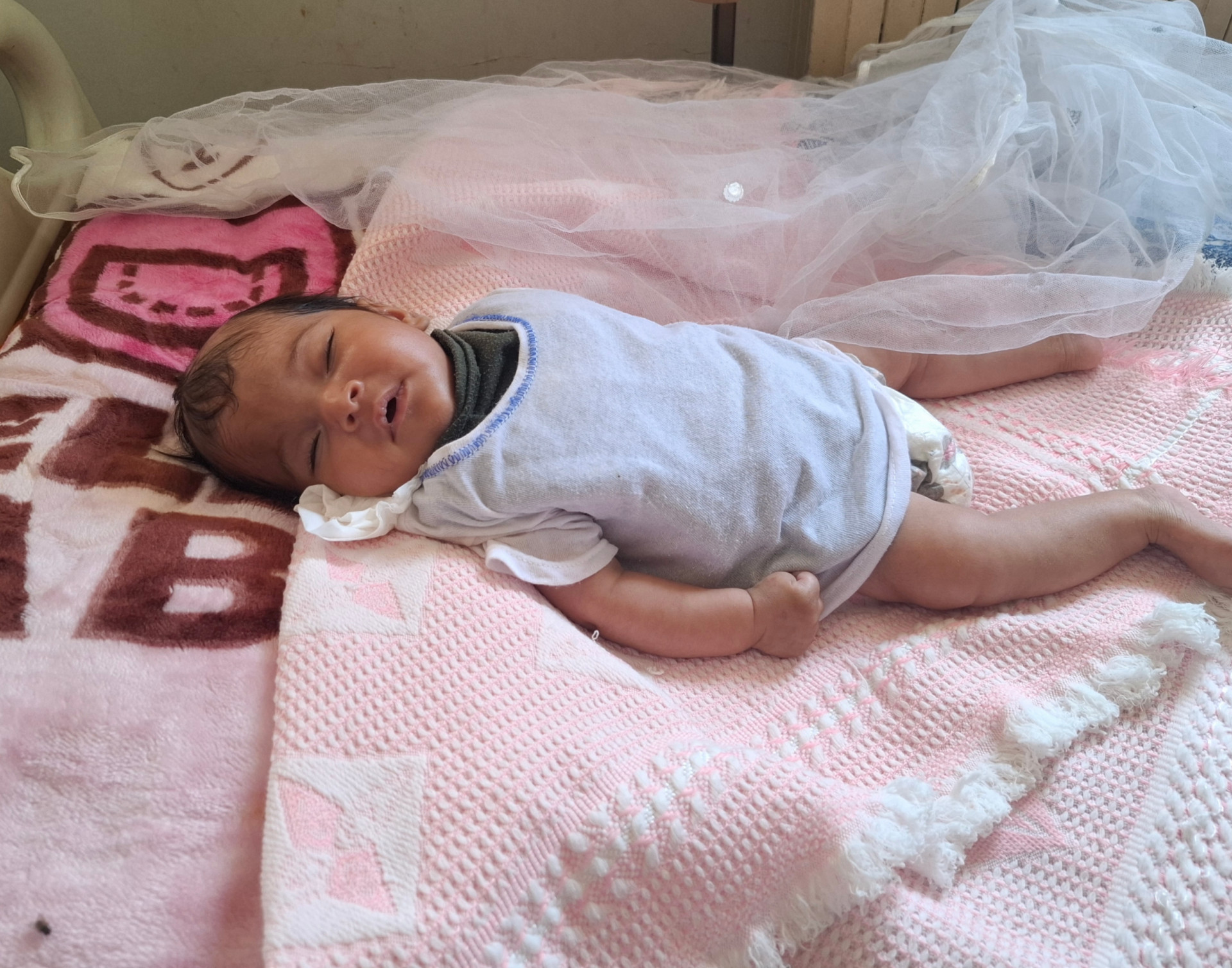 Hydrocephalus Threatens Her Life