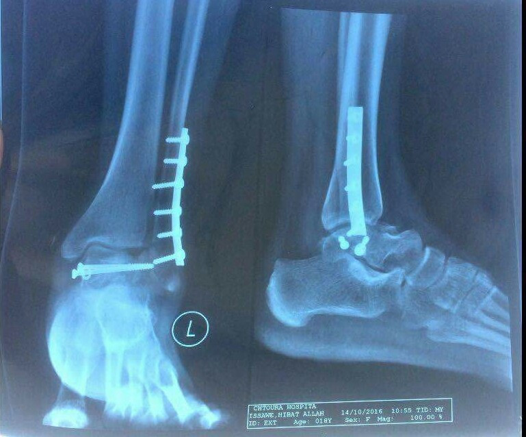 Young girl needing surgery expenses