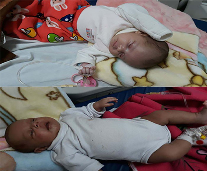 A twins need urgent medical care