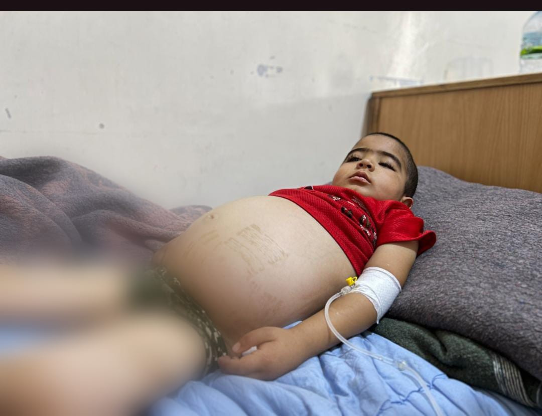 Ahmad Fights Illness… and His Hope Rests in Your Hands