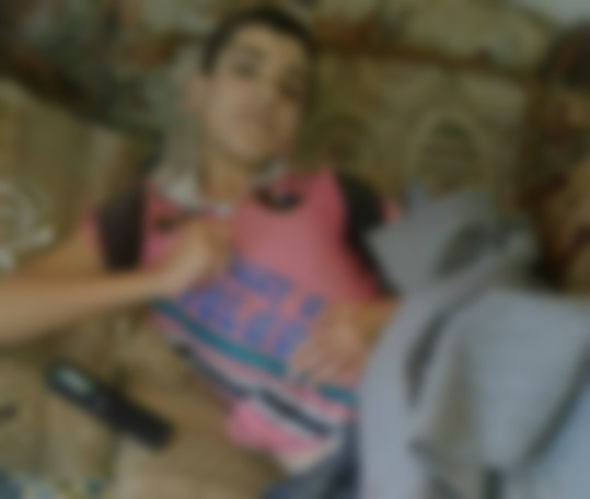 Child suffering from Hereditary Haemorrhagic Telangiectasi