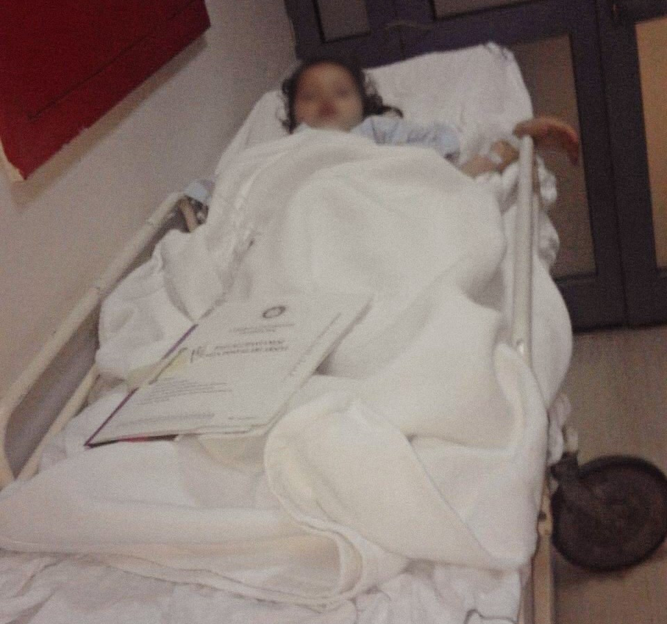 A girl had a congenital heart defect