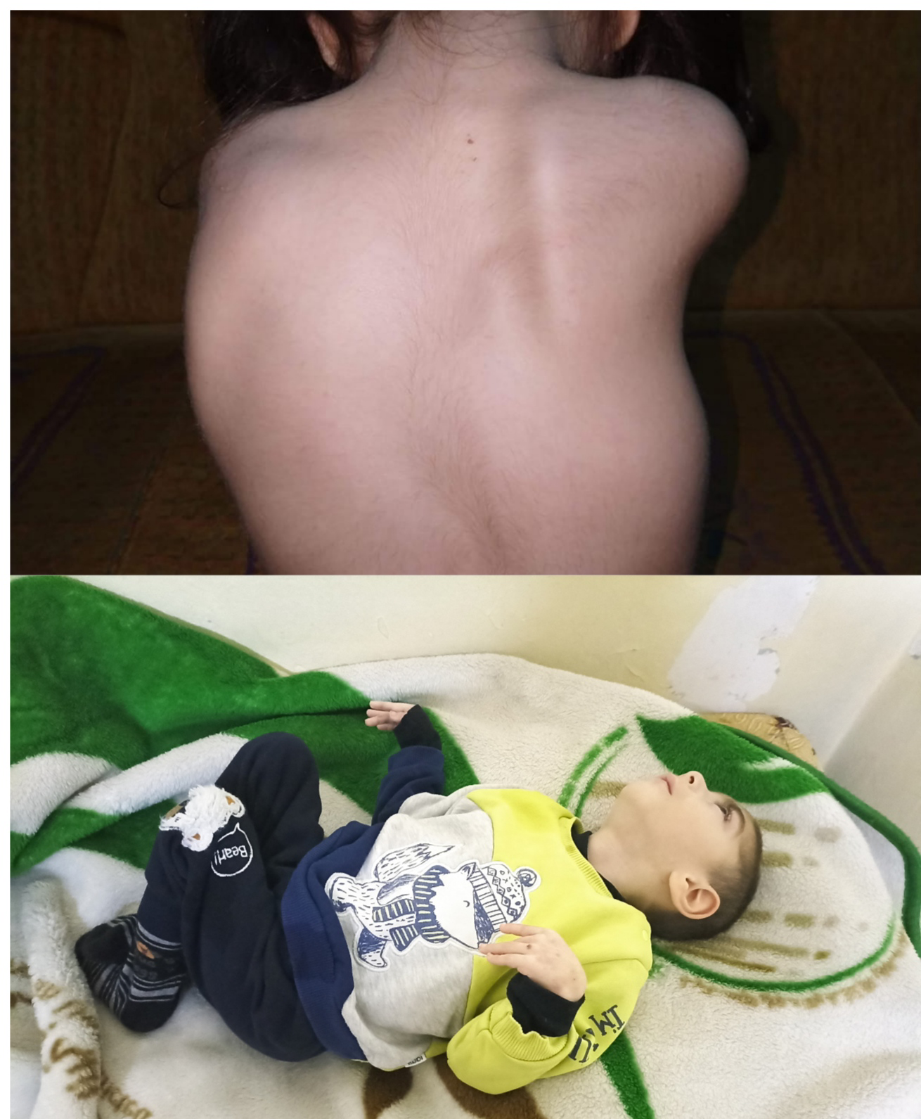 Sham and Ali need special medical care.