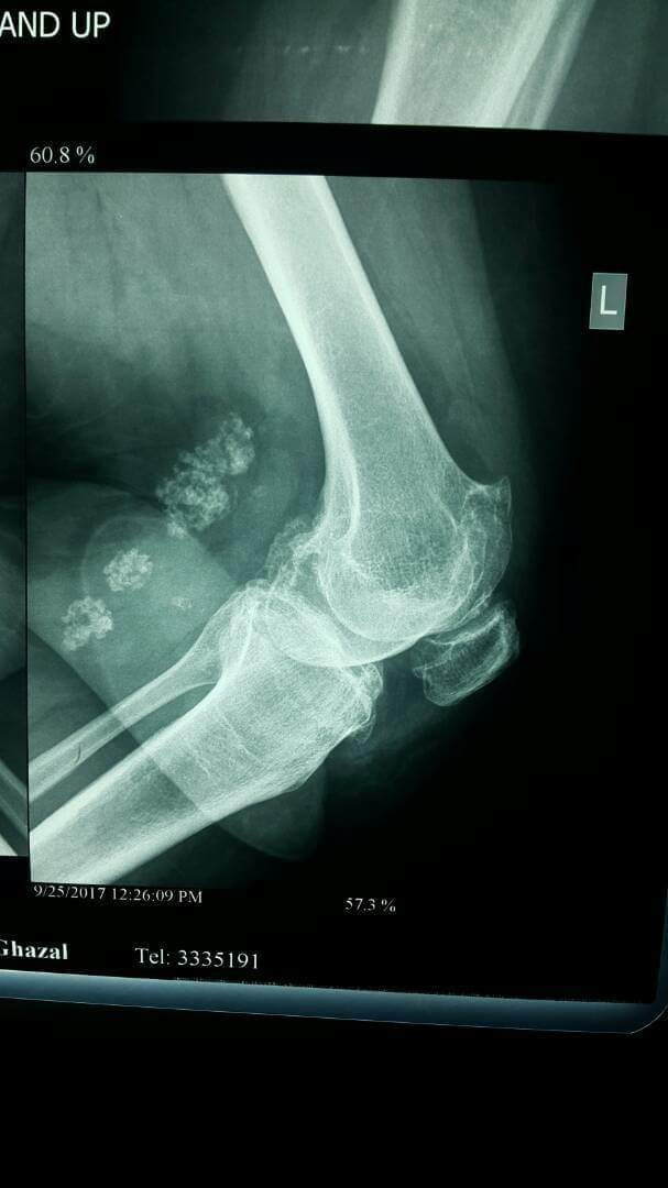 A lady in need of surgery
