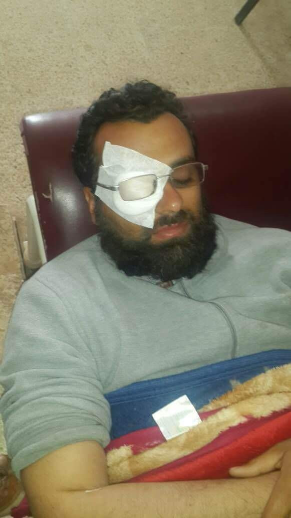 A young man needs an eye surgery