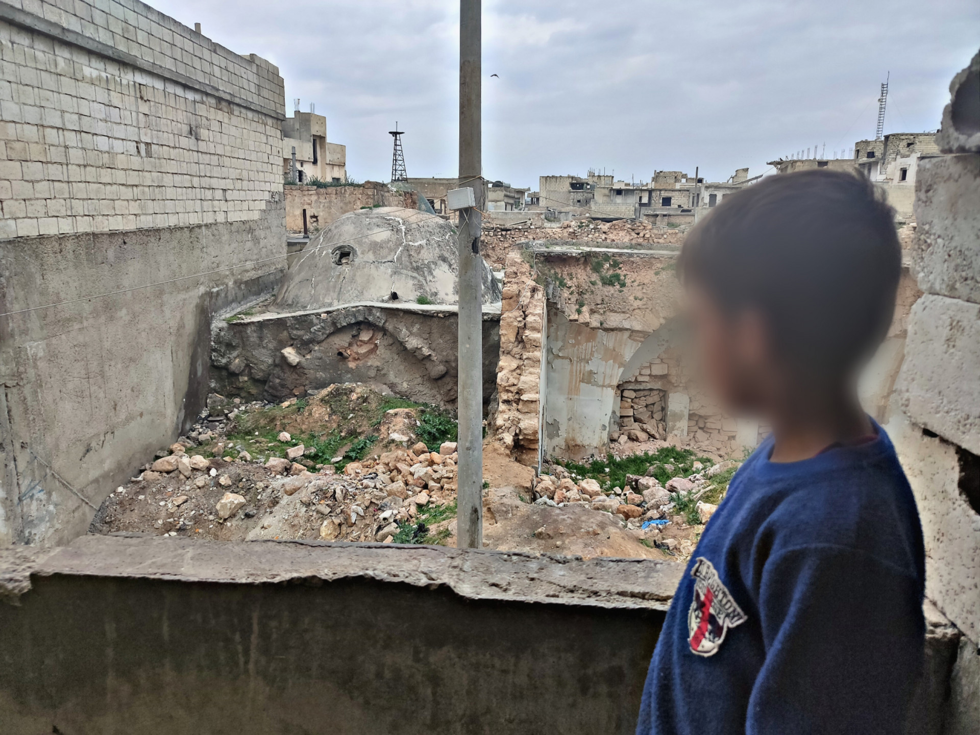 A little child needs lens implant