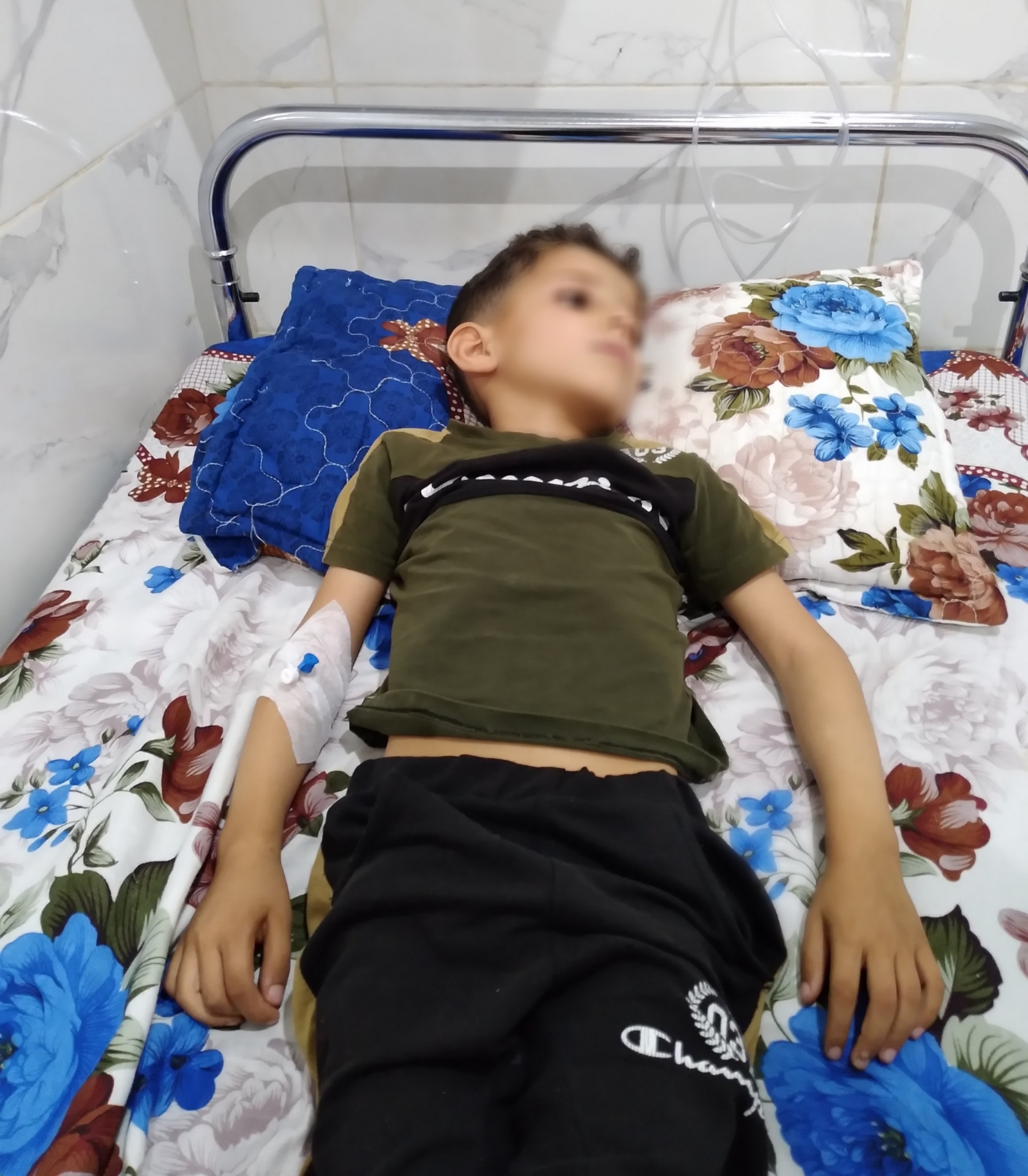 Mahmoud needs to undergo partial intestinal resection surgery due to the interstinal obstruction he suffers from several days ago