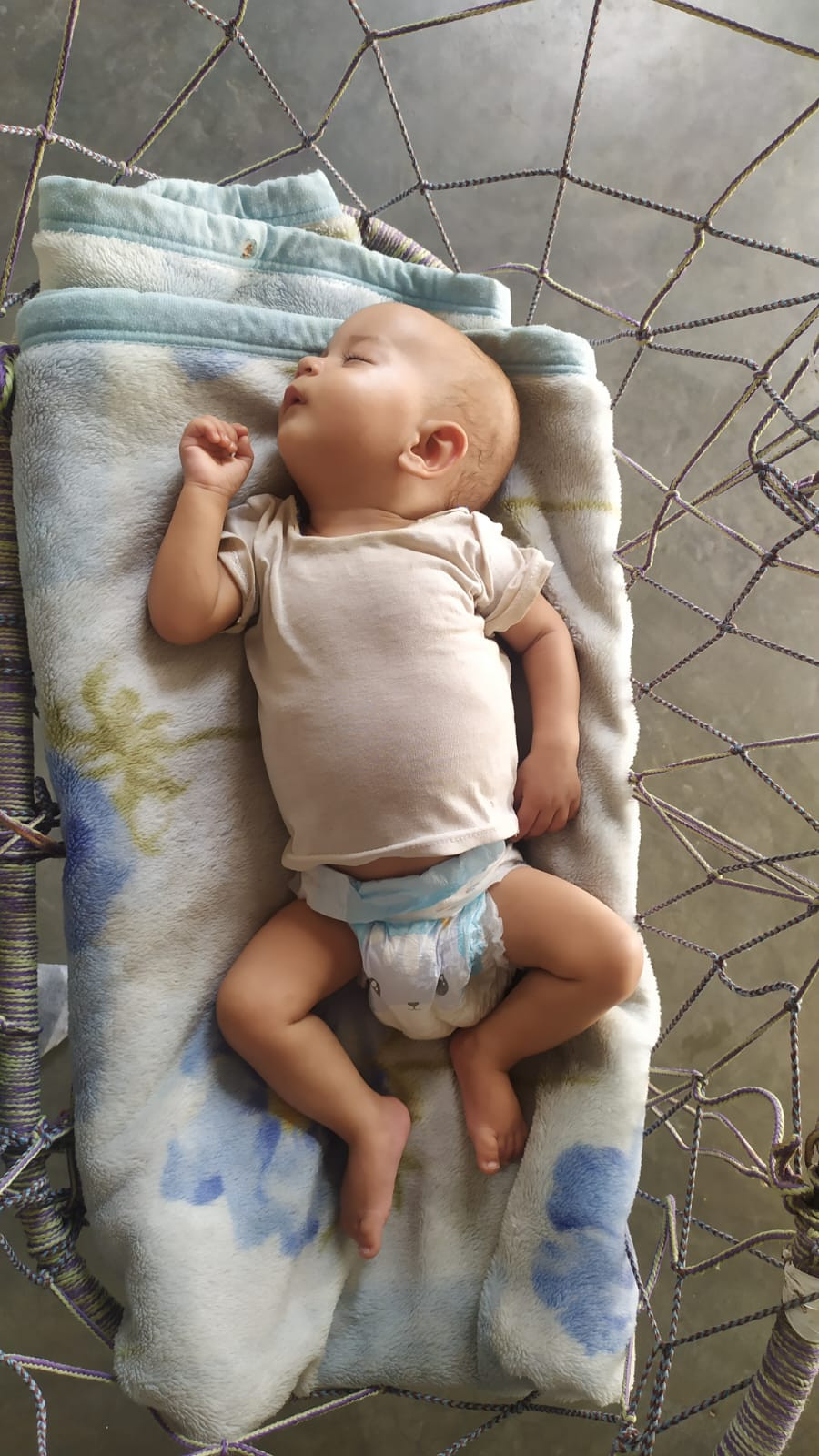 The little boy became malnourished as a result of the poor living situation of his family.