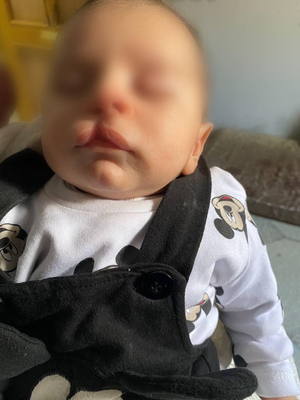 A newborn needs surgery