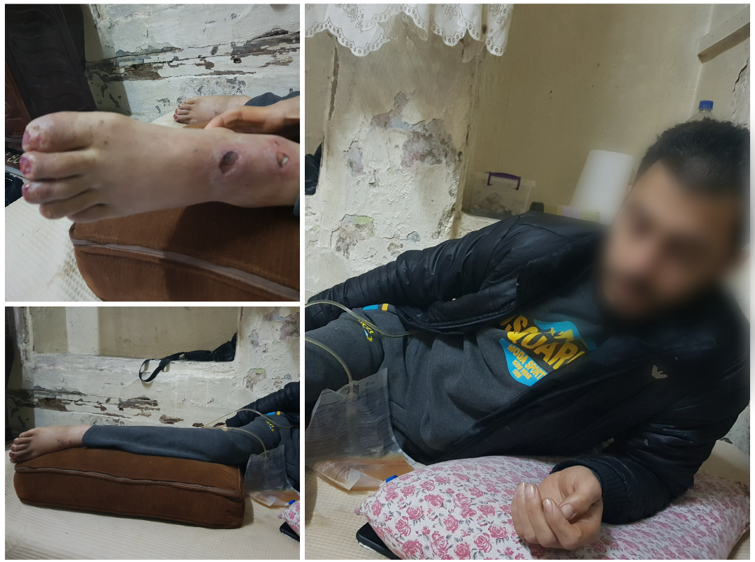 Young man suffer of paralysis .