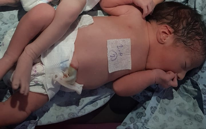 Due to the premature birth of four sets of twins, it's essential to admit them to the neonatal unit quickly.