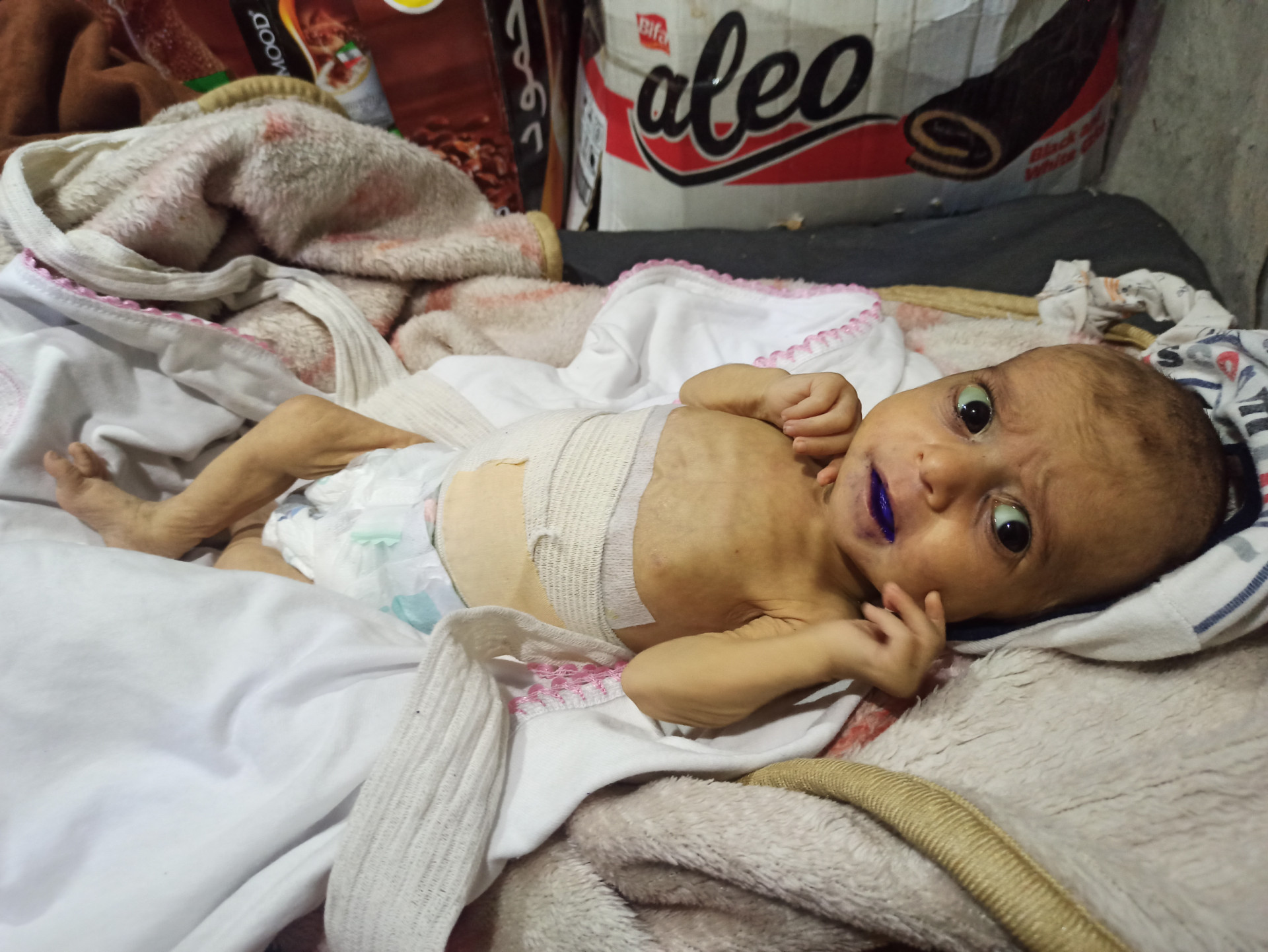 Biliary atresia disease prevented Lamees from living her childhood! She is waiting for your help!