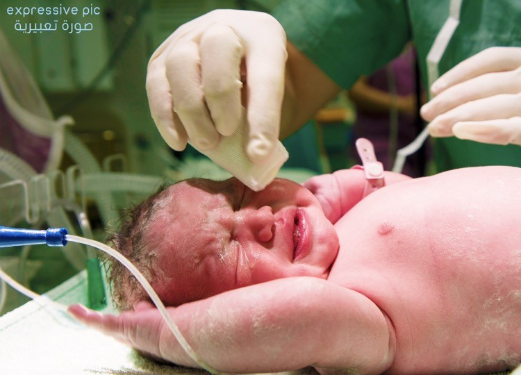 Pregnant woman needing c-section