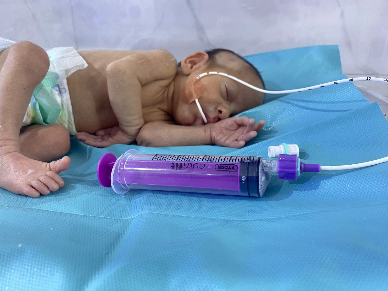 Aya is a child who needs your support to get medical care!