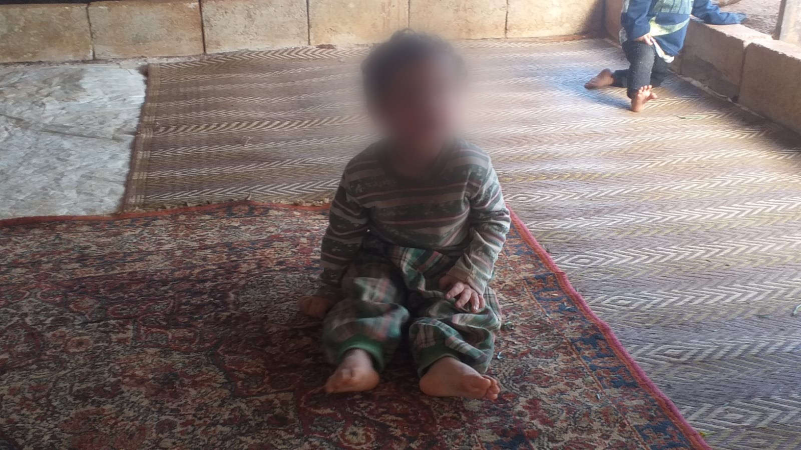 A poor child living in a poor tent needs medicines.