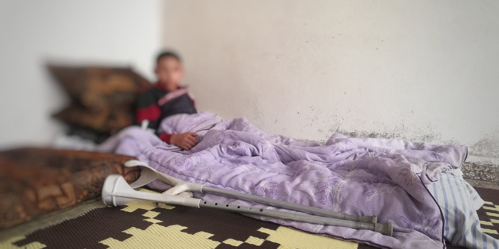 محمد يعاني من تقوّس في الأرجل وقطوع متعددة بالفخذ الأيسر، وهو بحاجة لأدوية علاجية