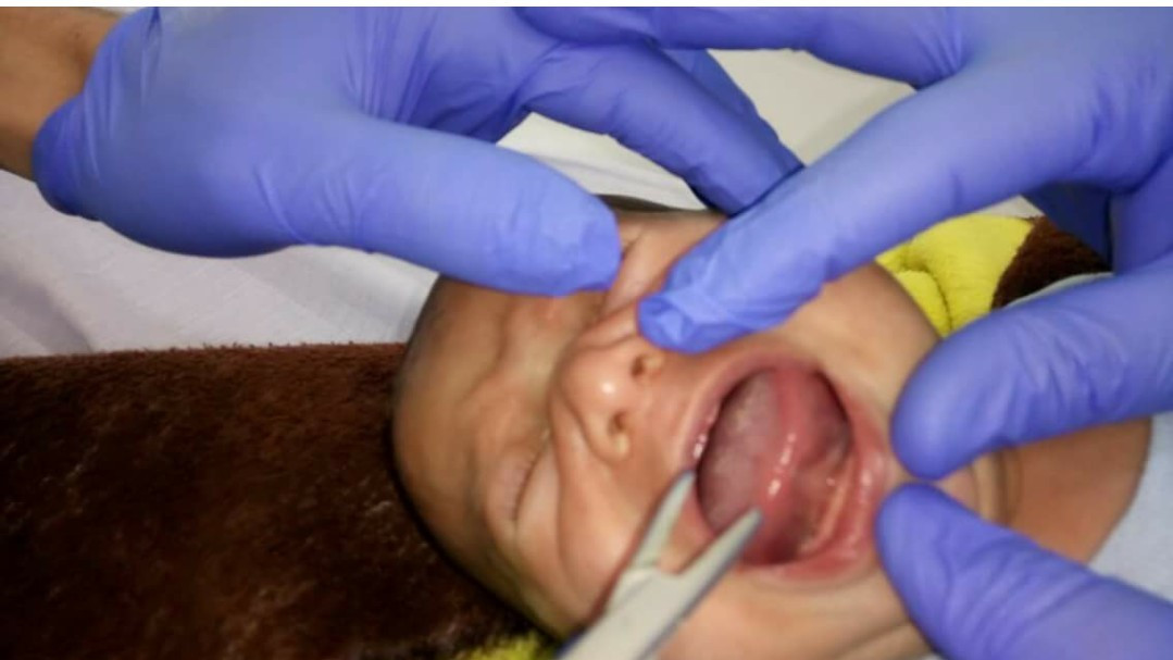 A little baby in need for treatment