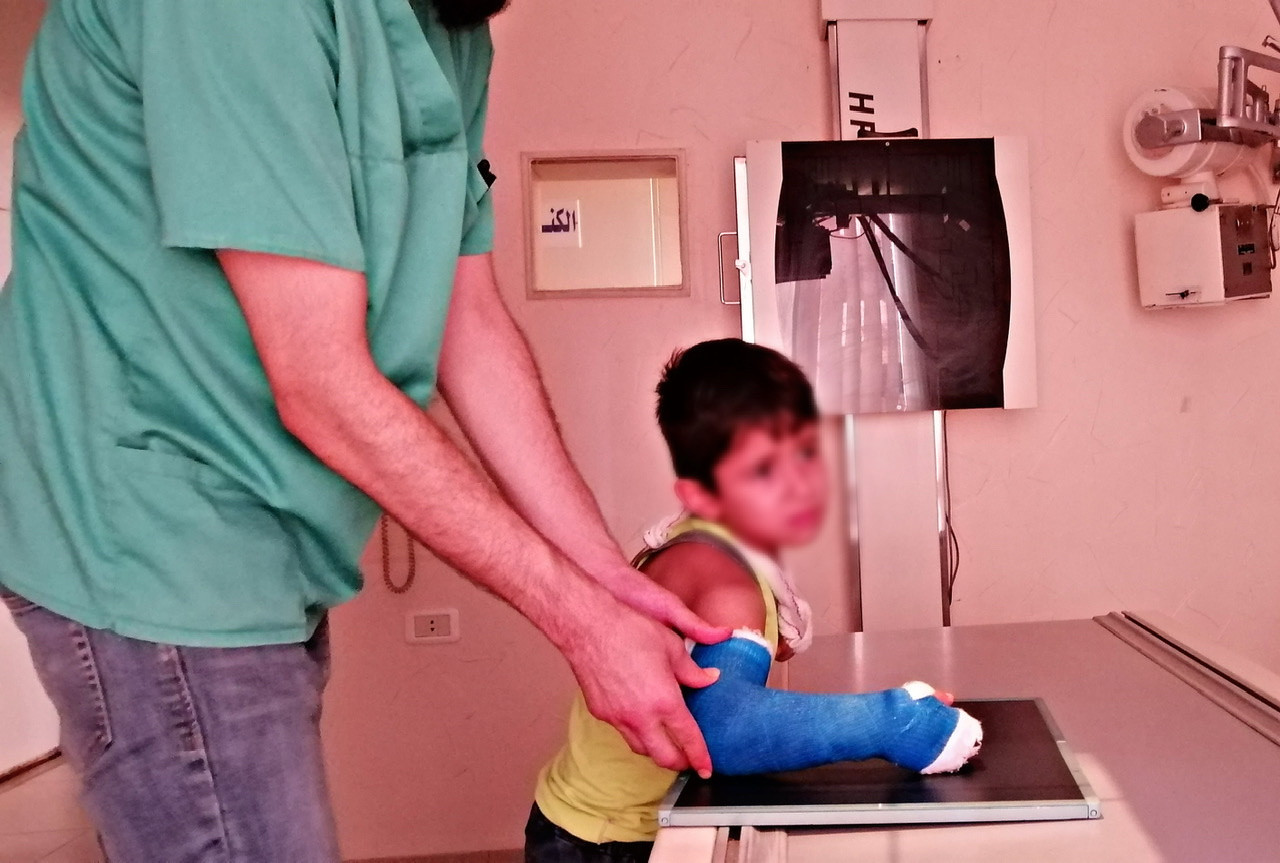 A little child is with bone fractures and needs surgery