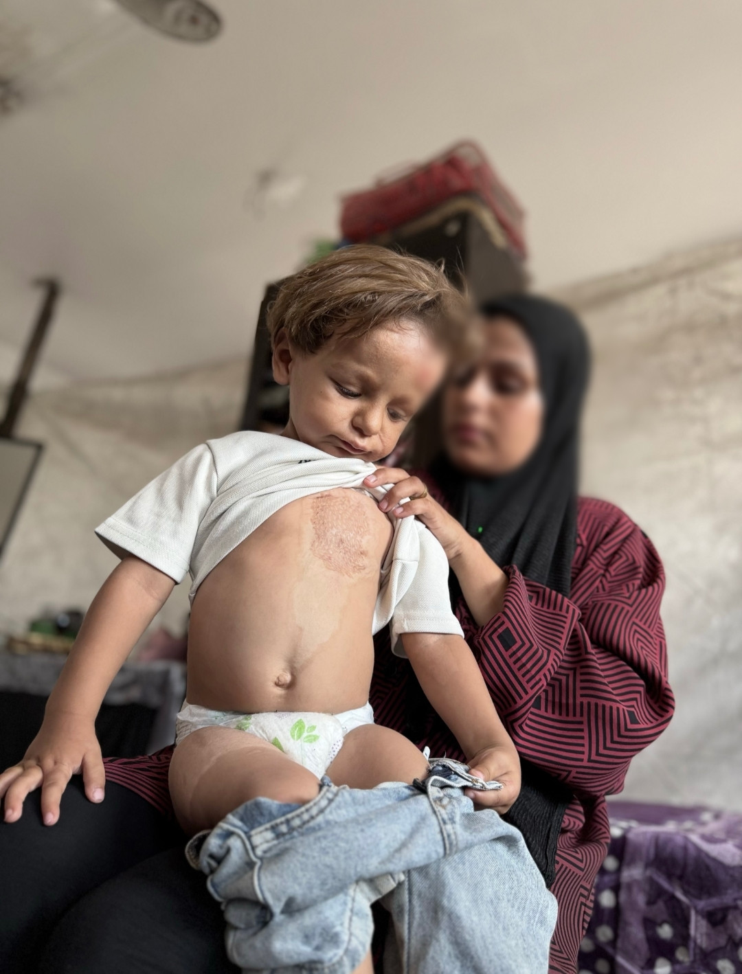 محمد... جسدٌ صغير يحمل وجعًا أكبر من عمره