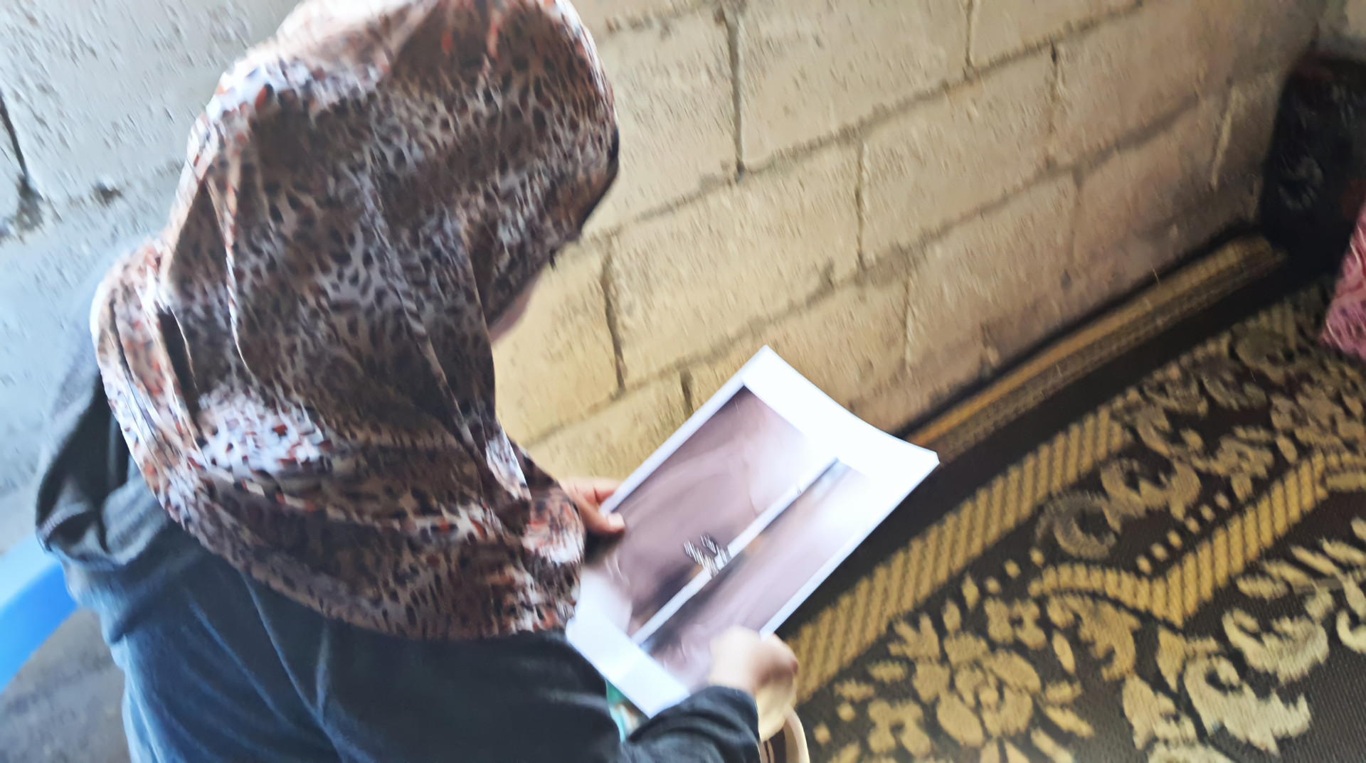 Khawla is with backbone and feet deformations, needs surgery