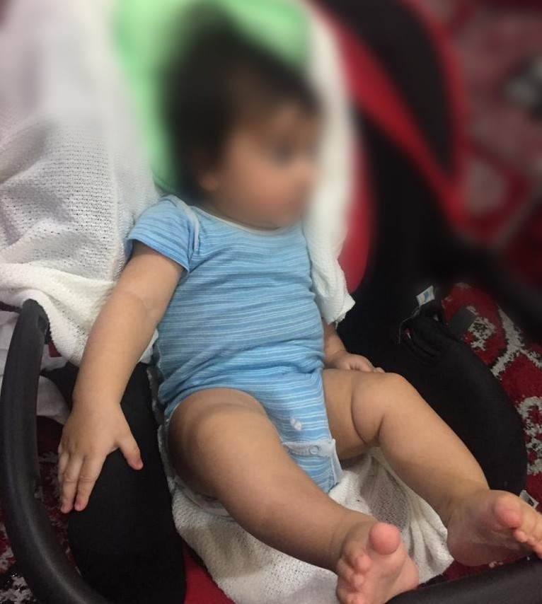 طفل يعاني من أمراض في الكلى، وهو بحاجة إلى صورتين نوويتين للكلى
