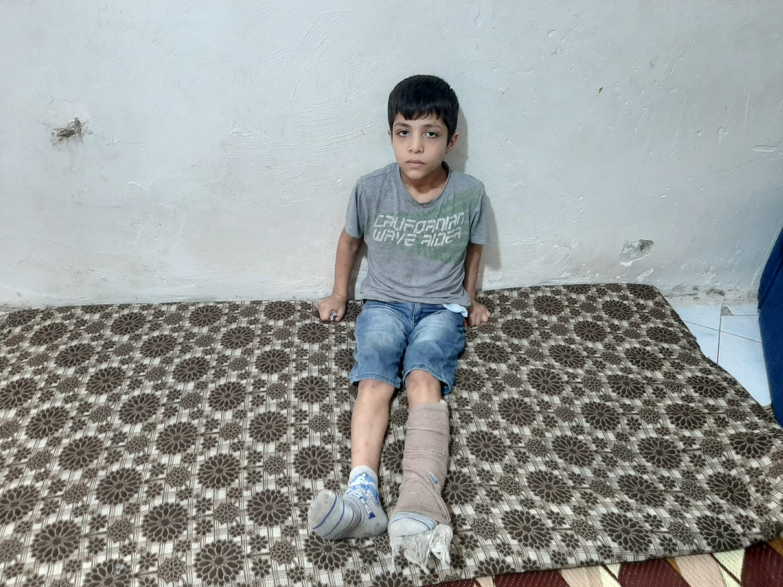 Disease surrounds Abd Al-basit’s family from every side!