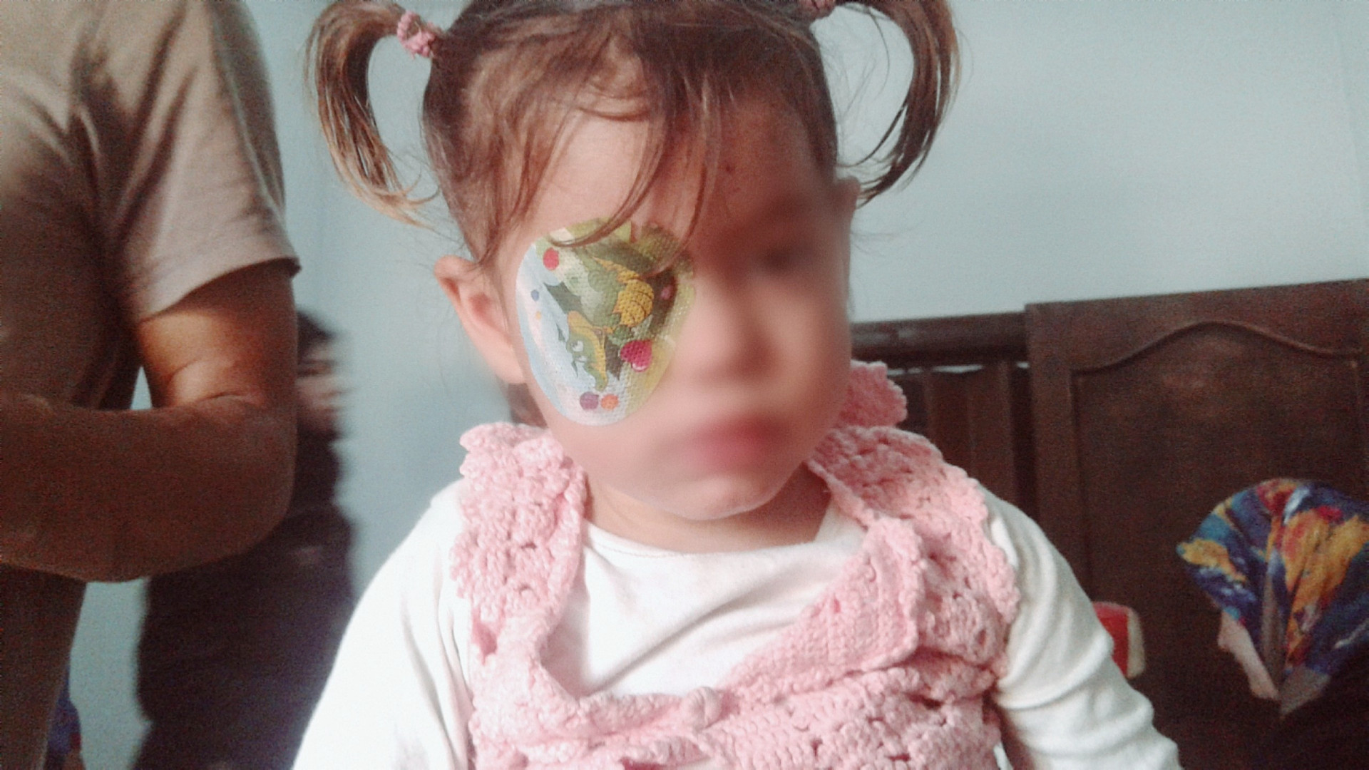 A girl with a damaged cornea