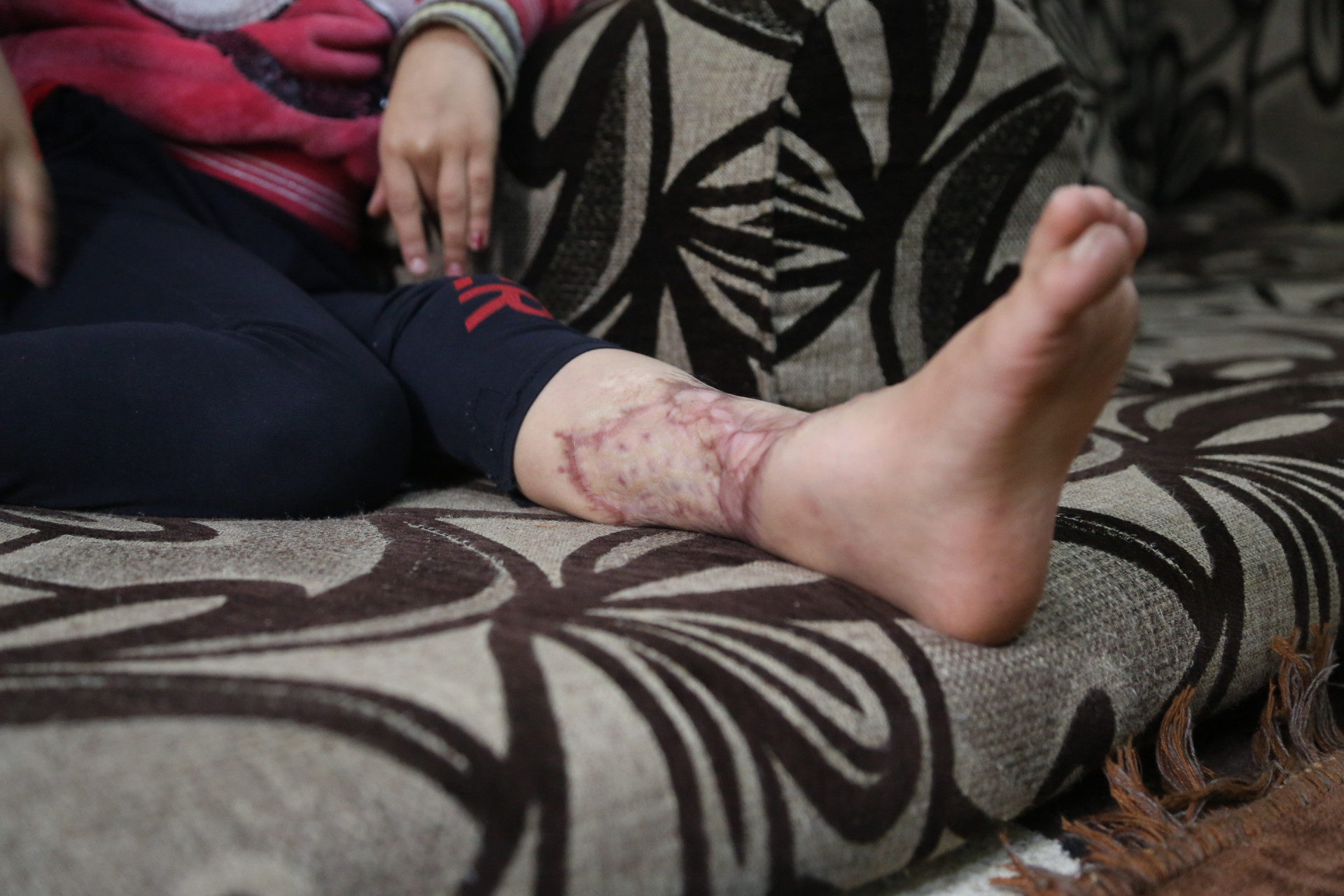 Rimas needs your help to get treatment