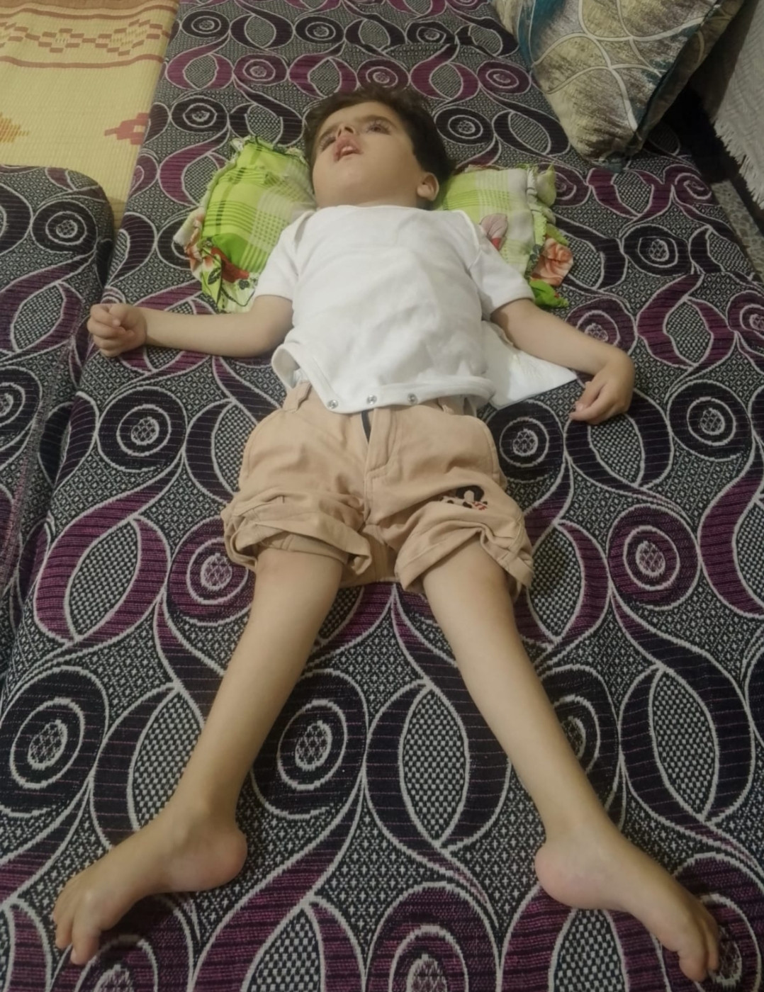 محمد… عائلة نازحة وطفل ينتظر العلاج