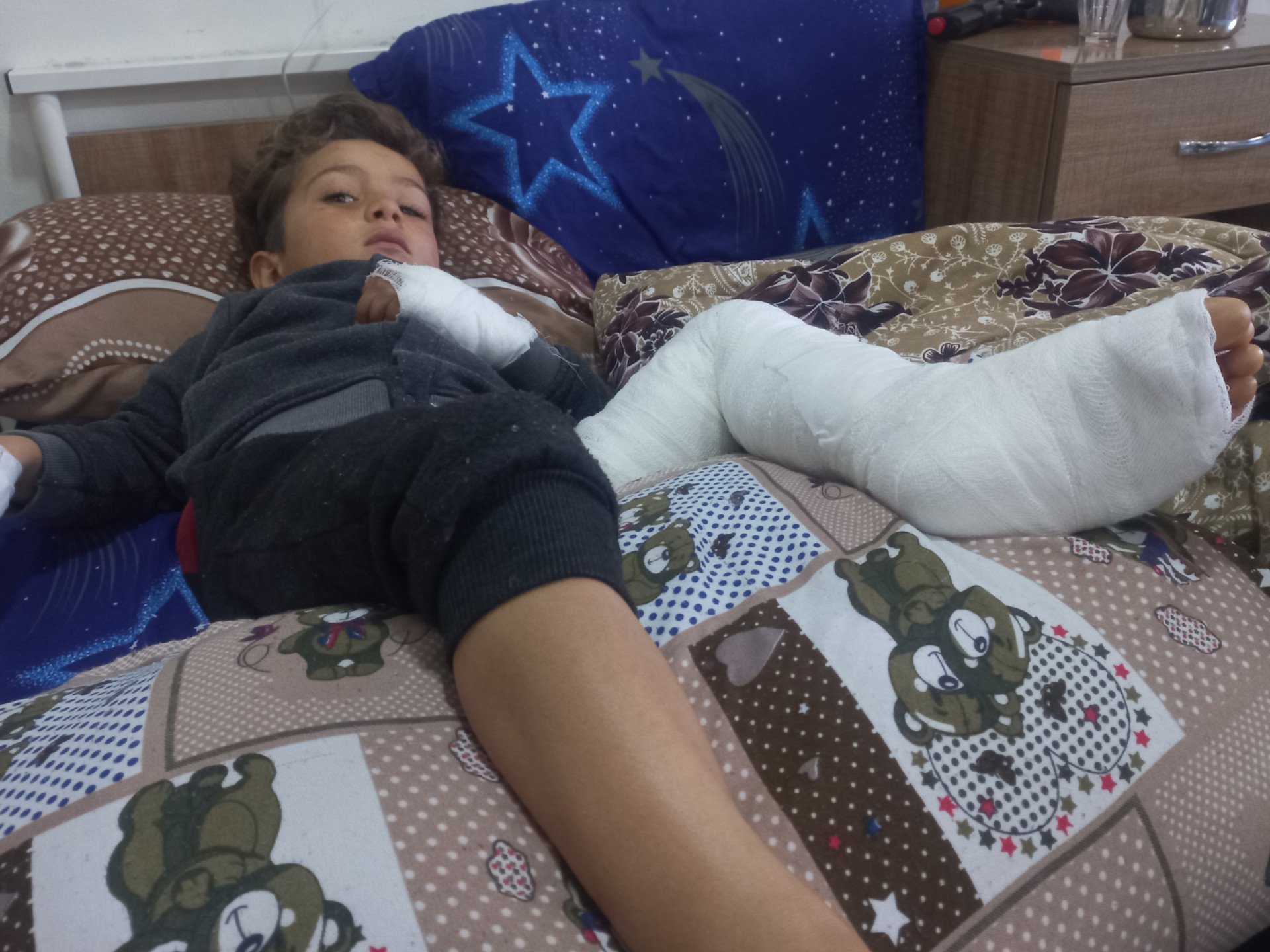 Burn injuries destroyed his childhood!