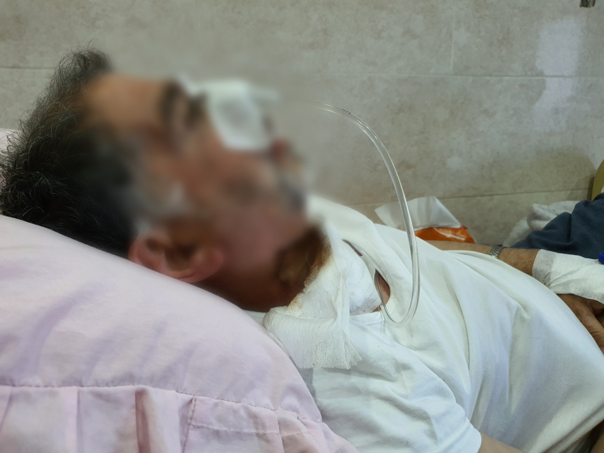 Mohammed suffers from gangrene that extended from his neck to shoulder, and he urgently needs to undergo surgery