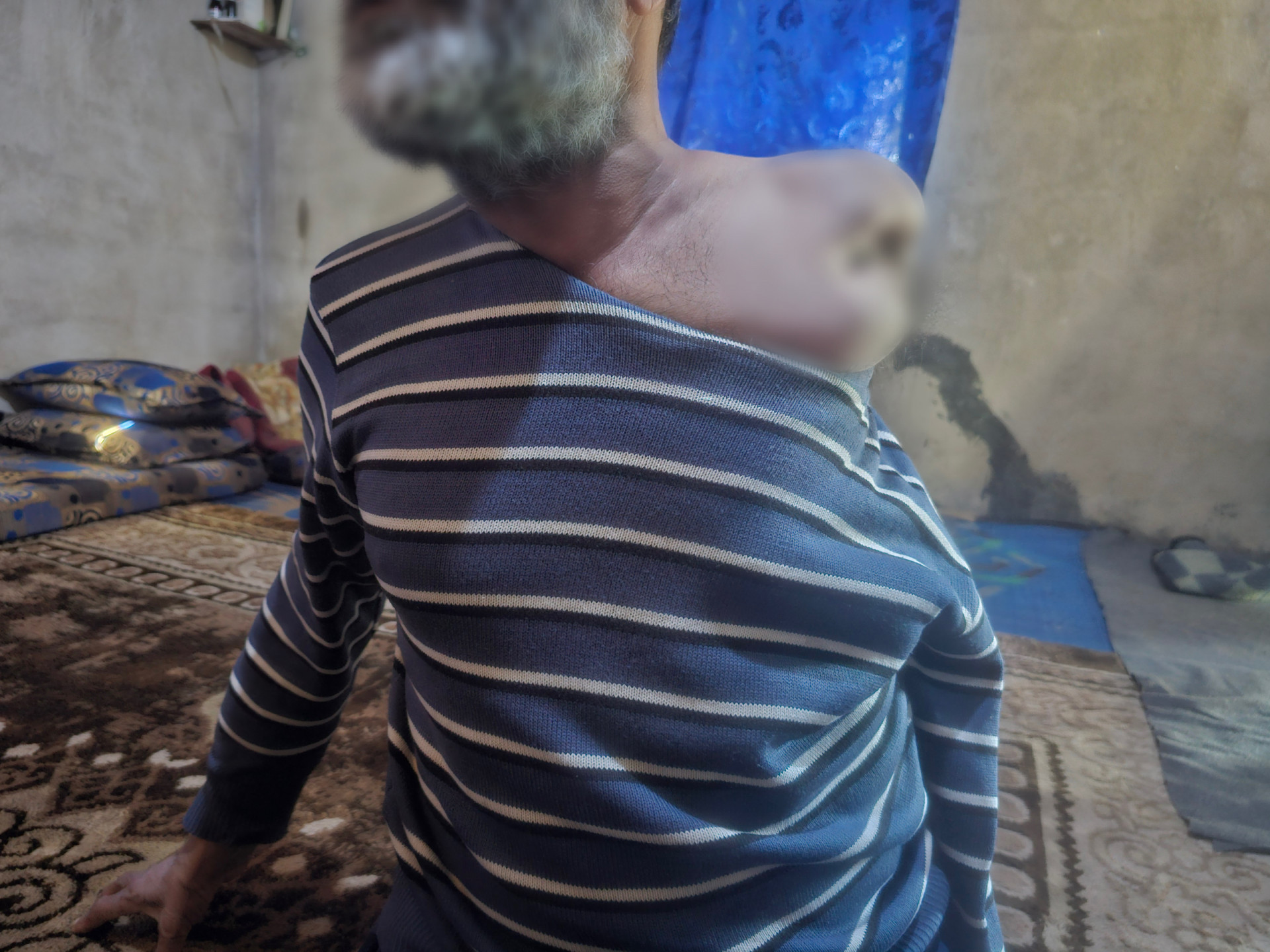 A Tent That Cannot Protect