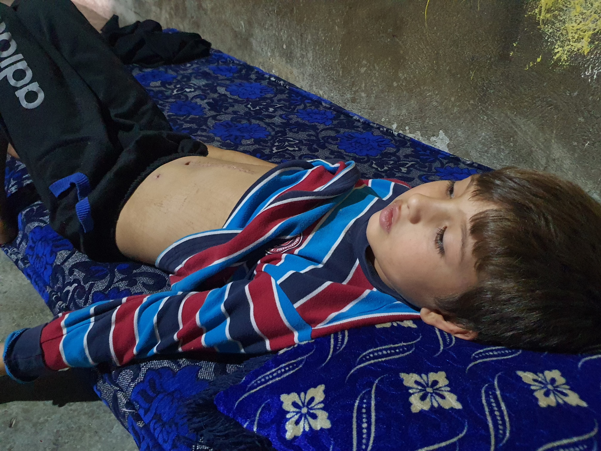 Save Subhi from pain. every donation makes a difference!