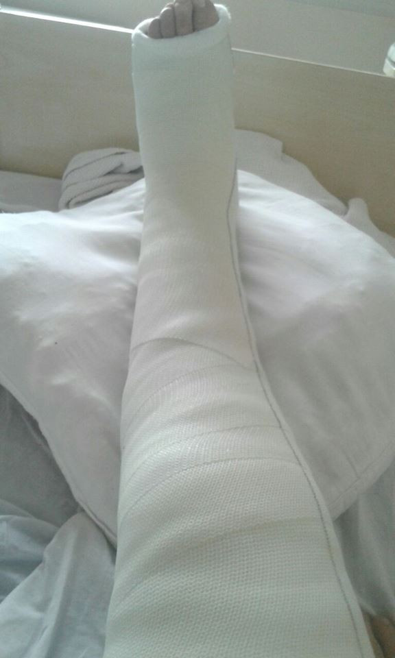 A young man injured by a shell in his foot