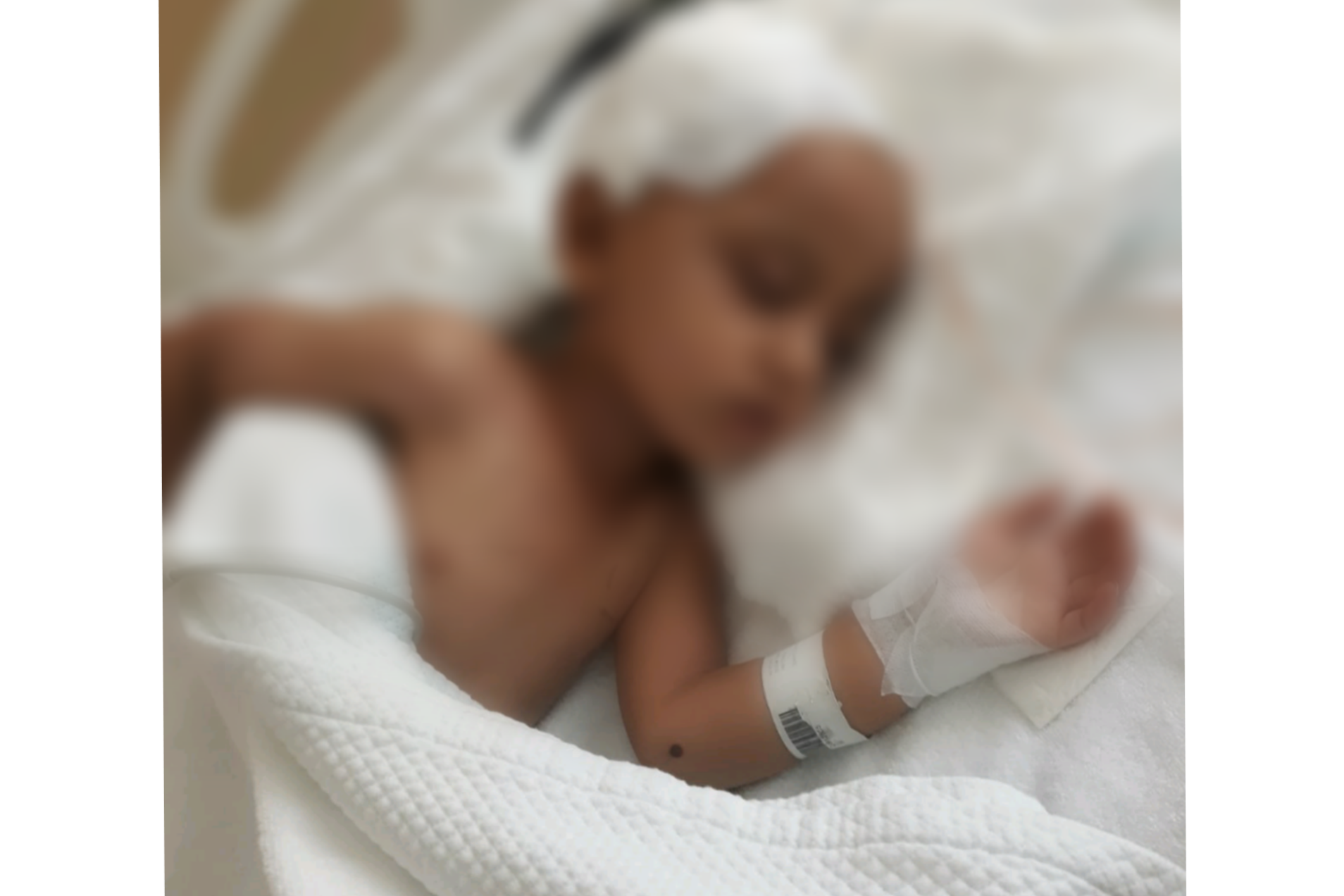 A child with Leukemia