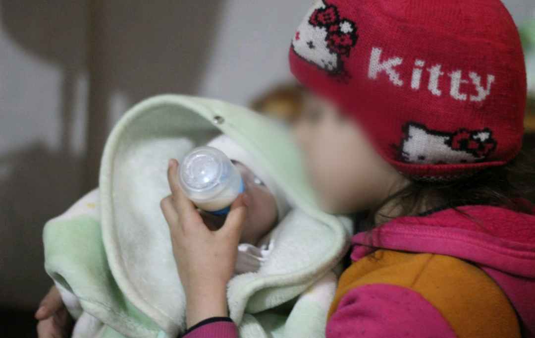 A kid with cleft palate