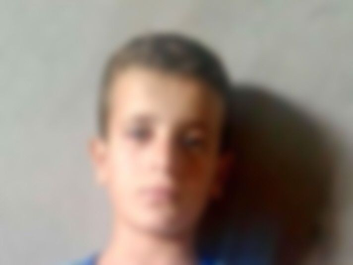 Child needing eye surgery