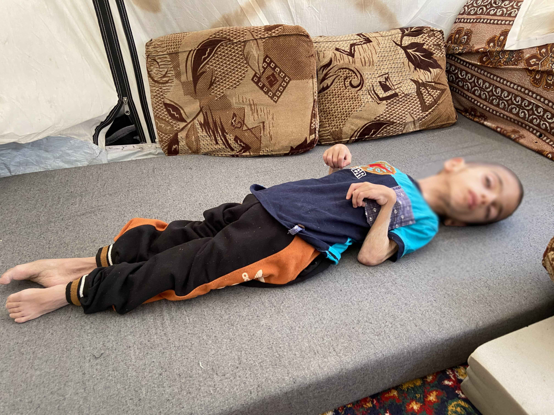 A kid with cerebral atrophy needs your help