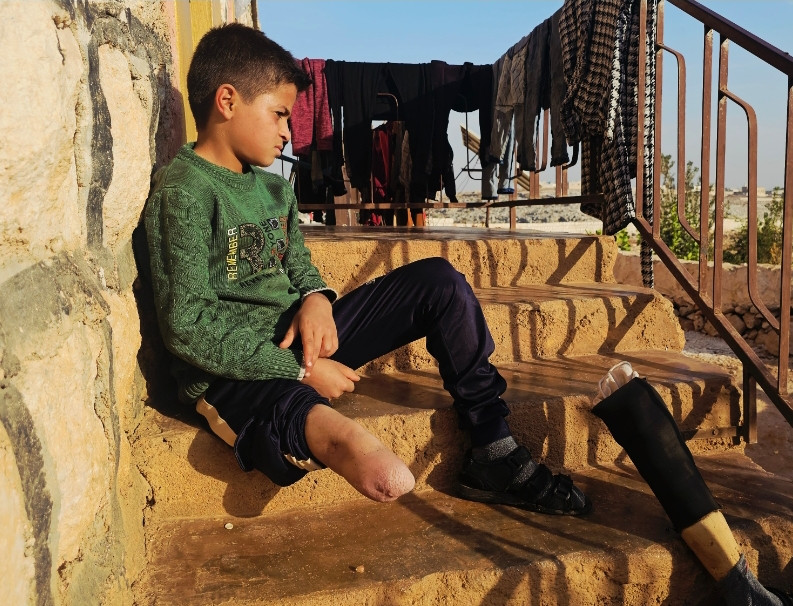 اصابةٌ غيرت مجرى حياتهم!