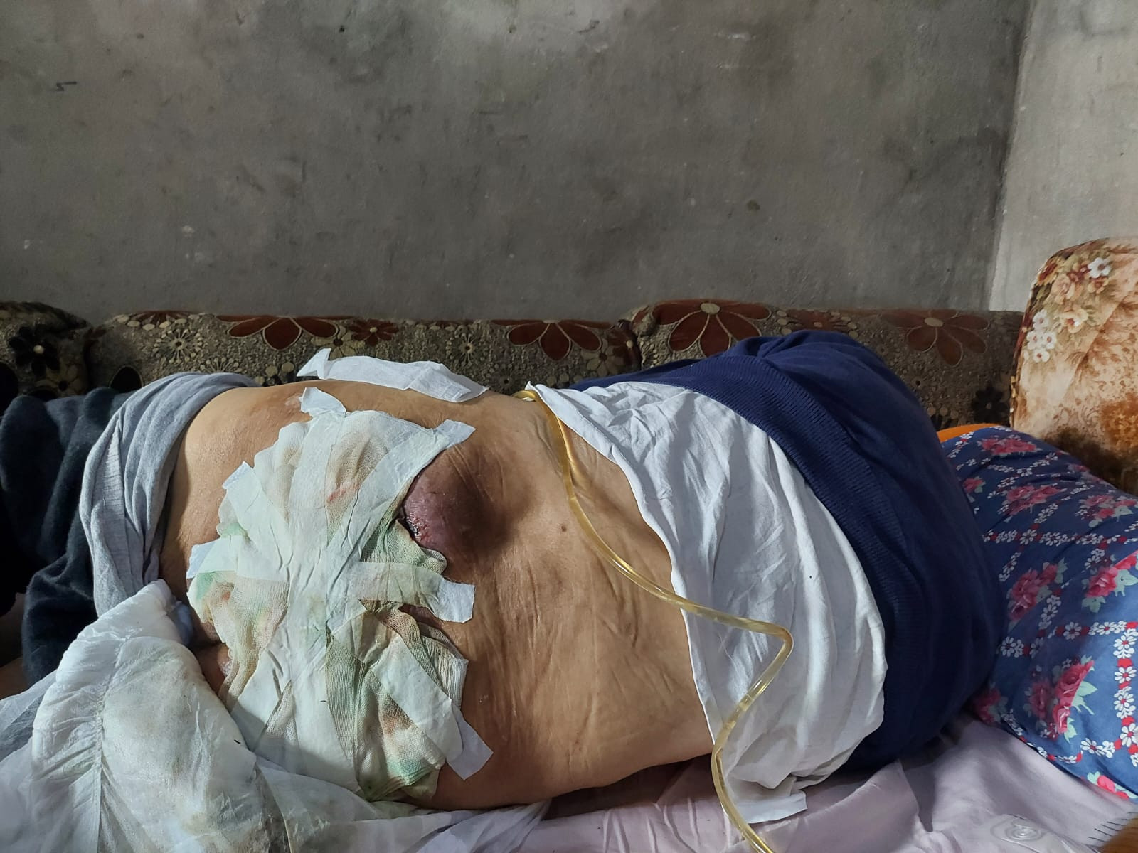 He is paralysed, has bedsores, and needs medication and diapers!