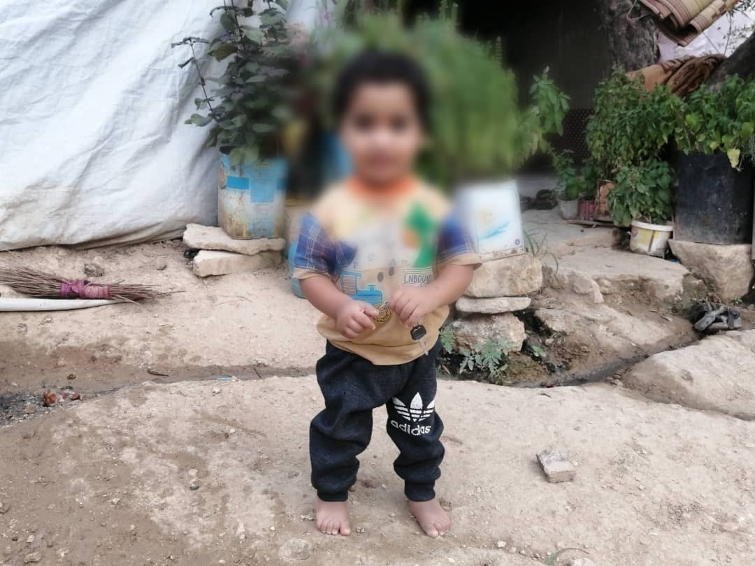 A little child needs surgery