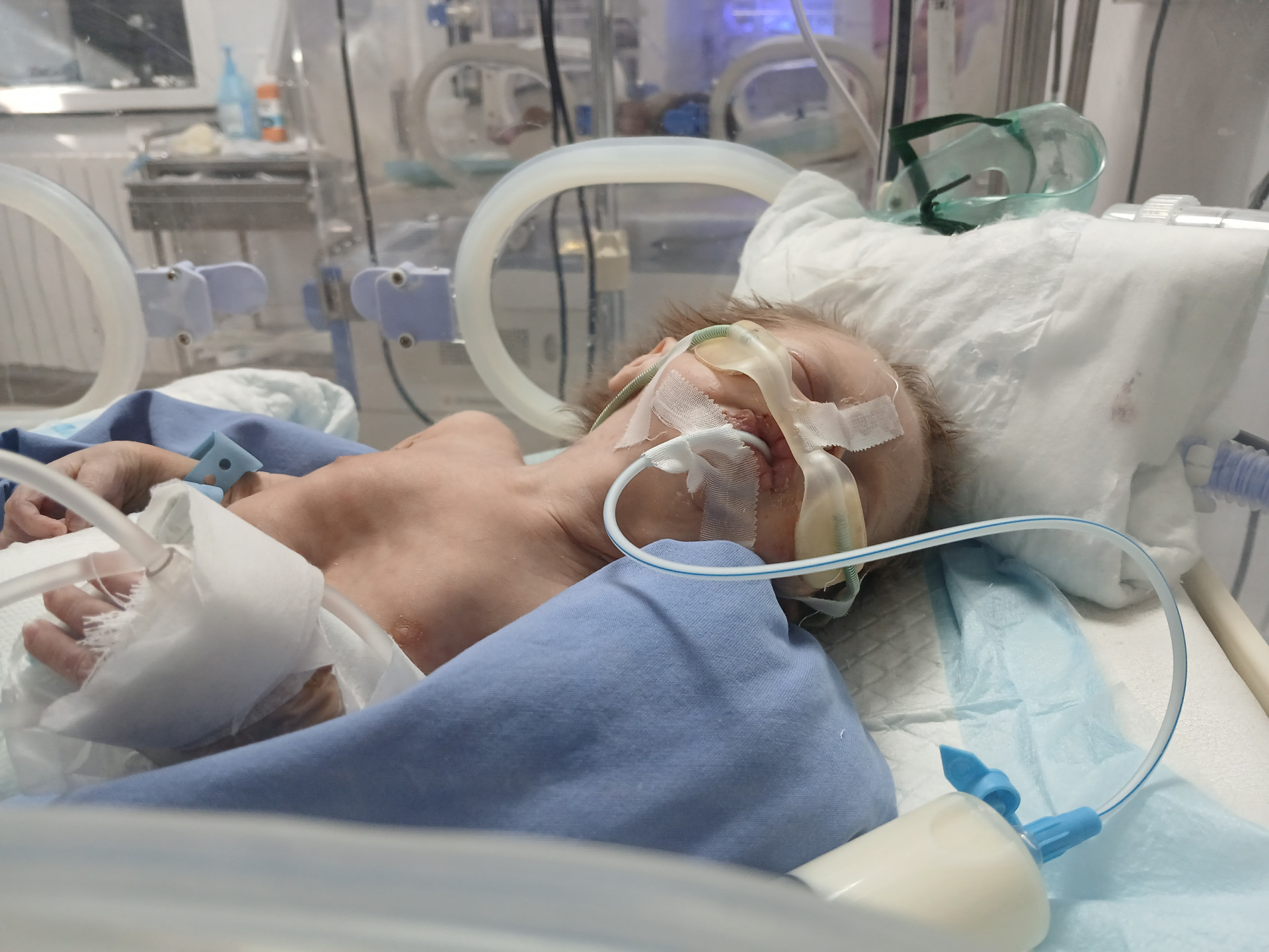 Mohammed’s Story: A Fight for Life from the Very Beginning