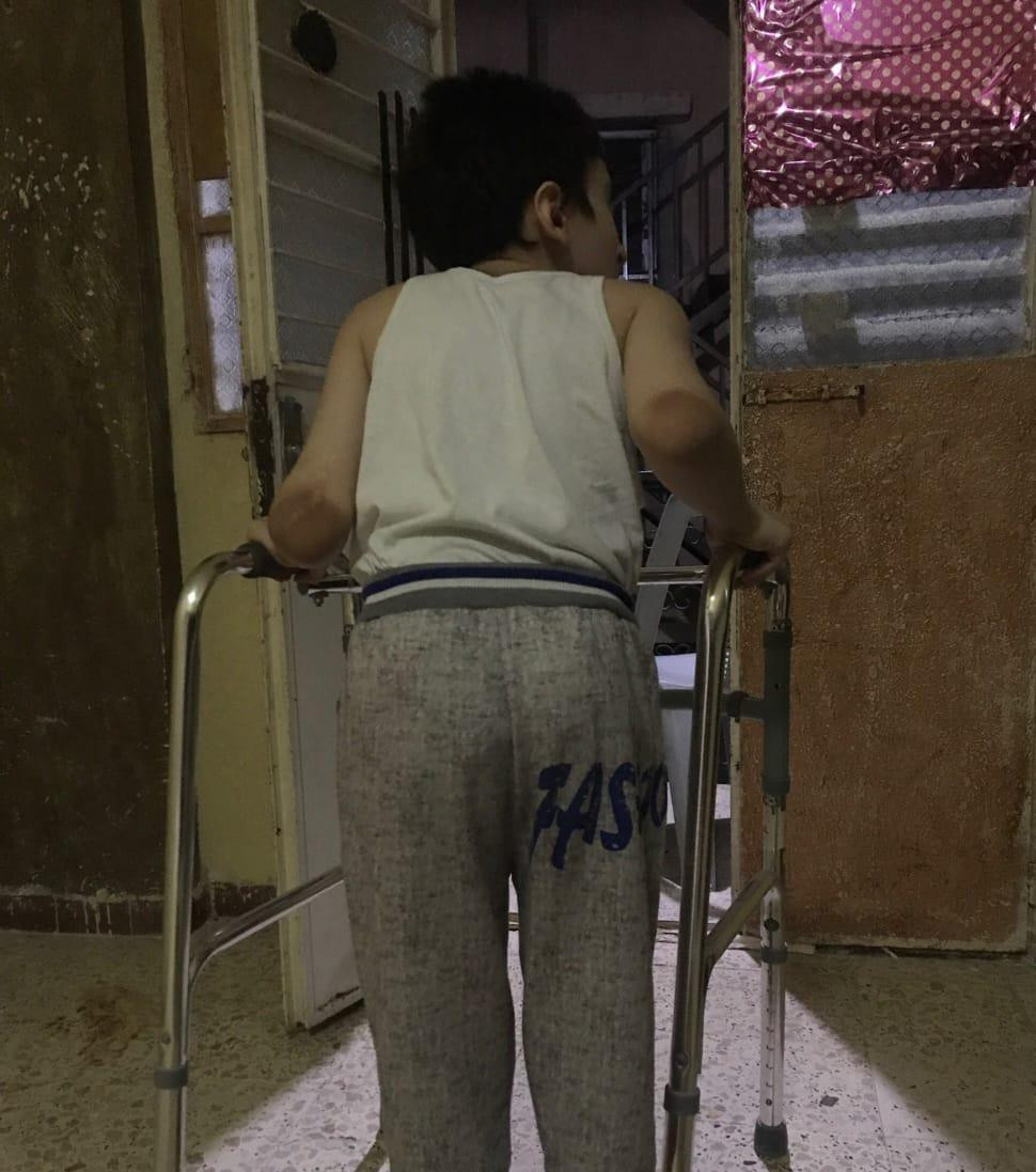 Hadi suffers from retinal damage, loss of speech and disability.
