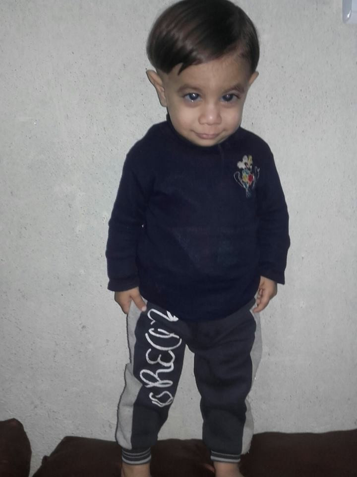 A Child Needs to Undergo Surgery