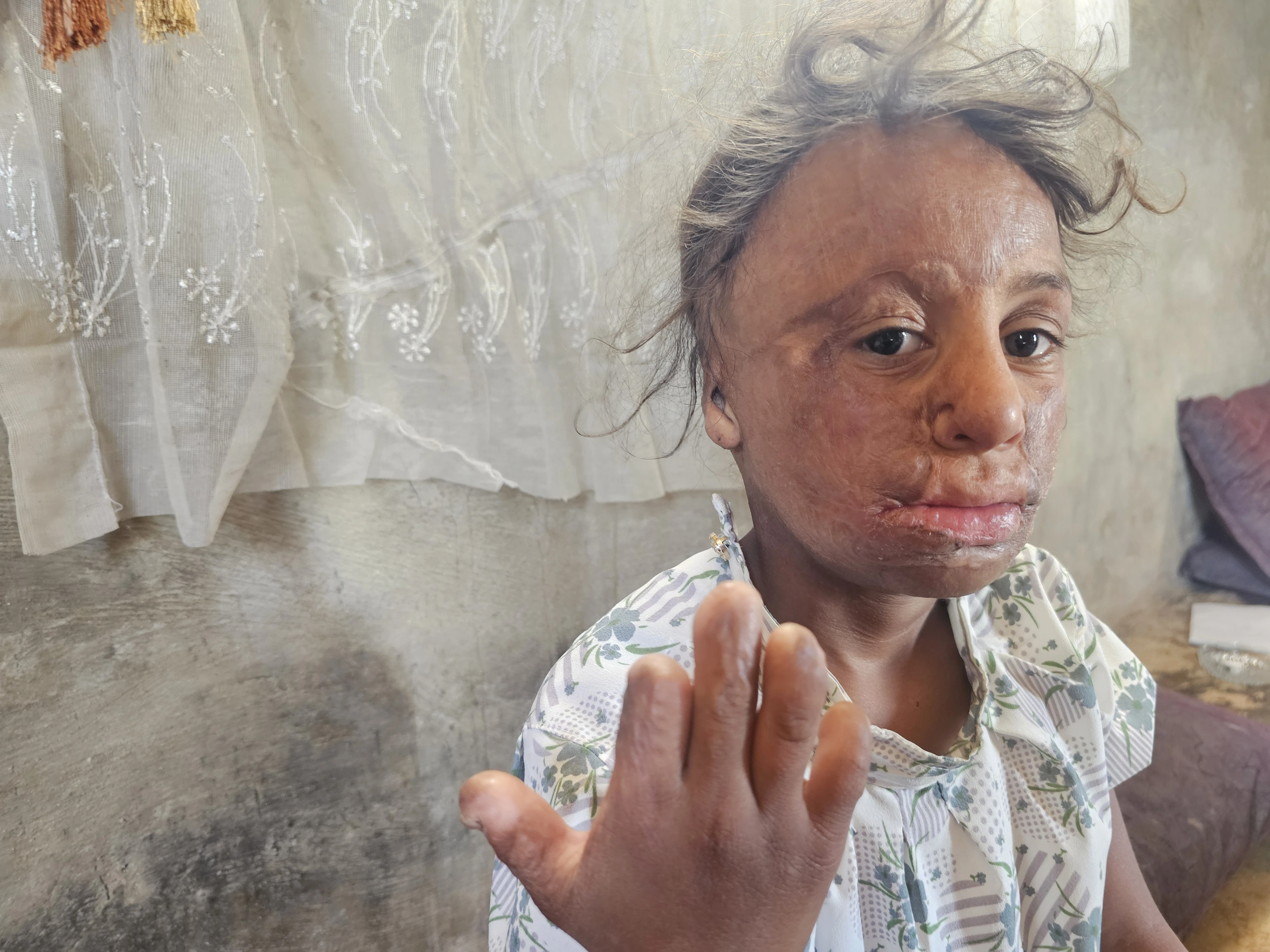 Urgent humanitarian cases