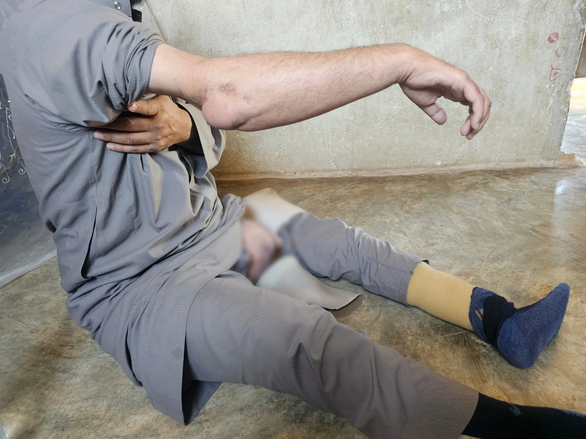 علاء ..كفاح أب أنهكتهُ الأصابة
