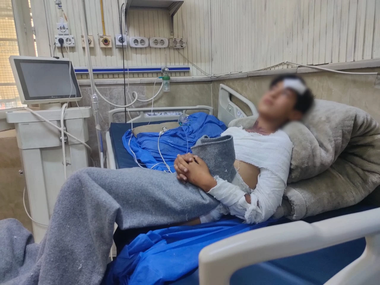 أحمد بين لهيب الحروق وأمل الشفاء