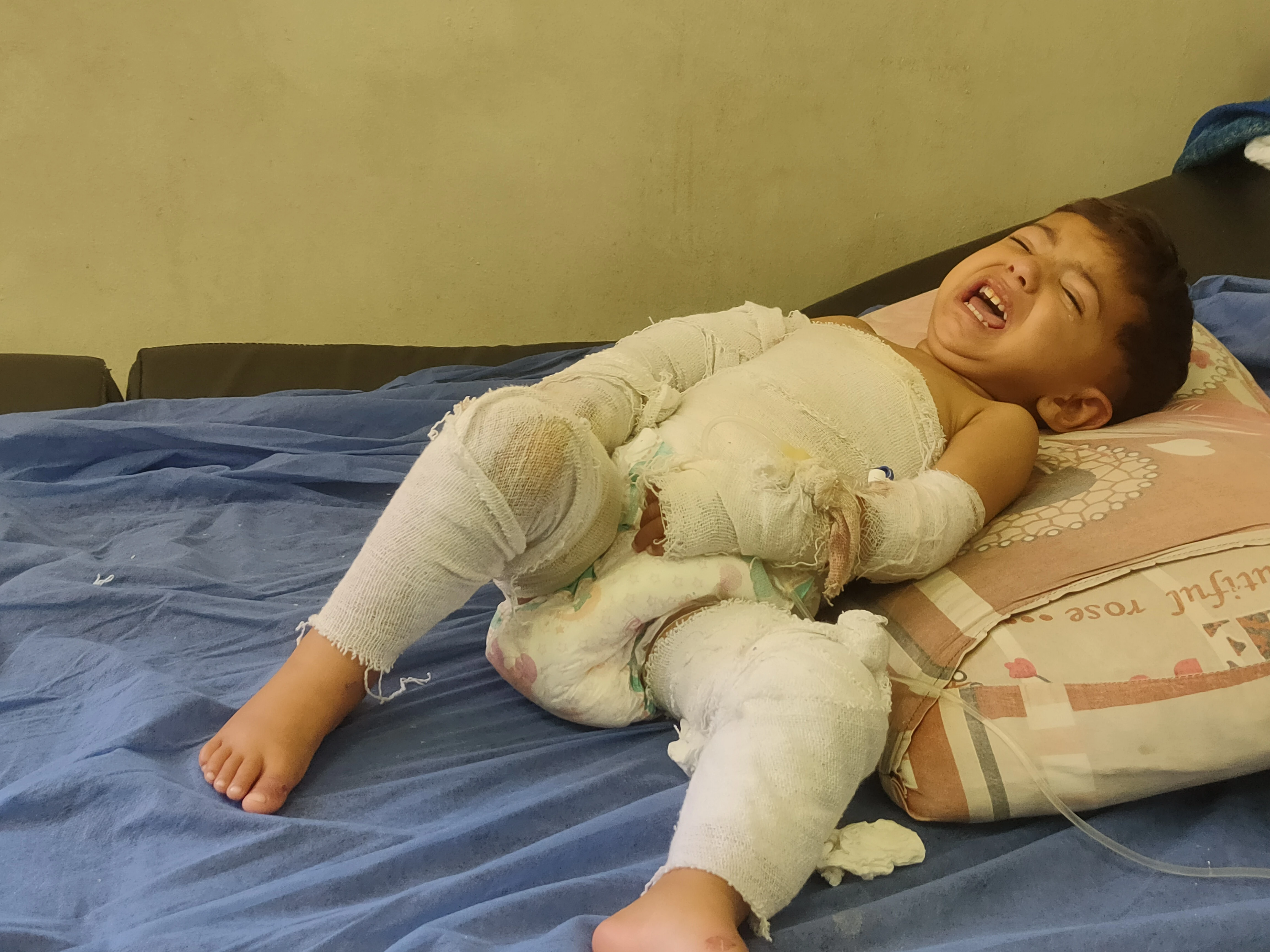 لهيبٌ غيّر طفولة معتصم