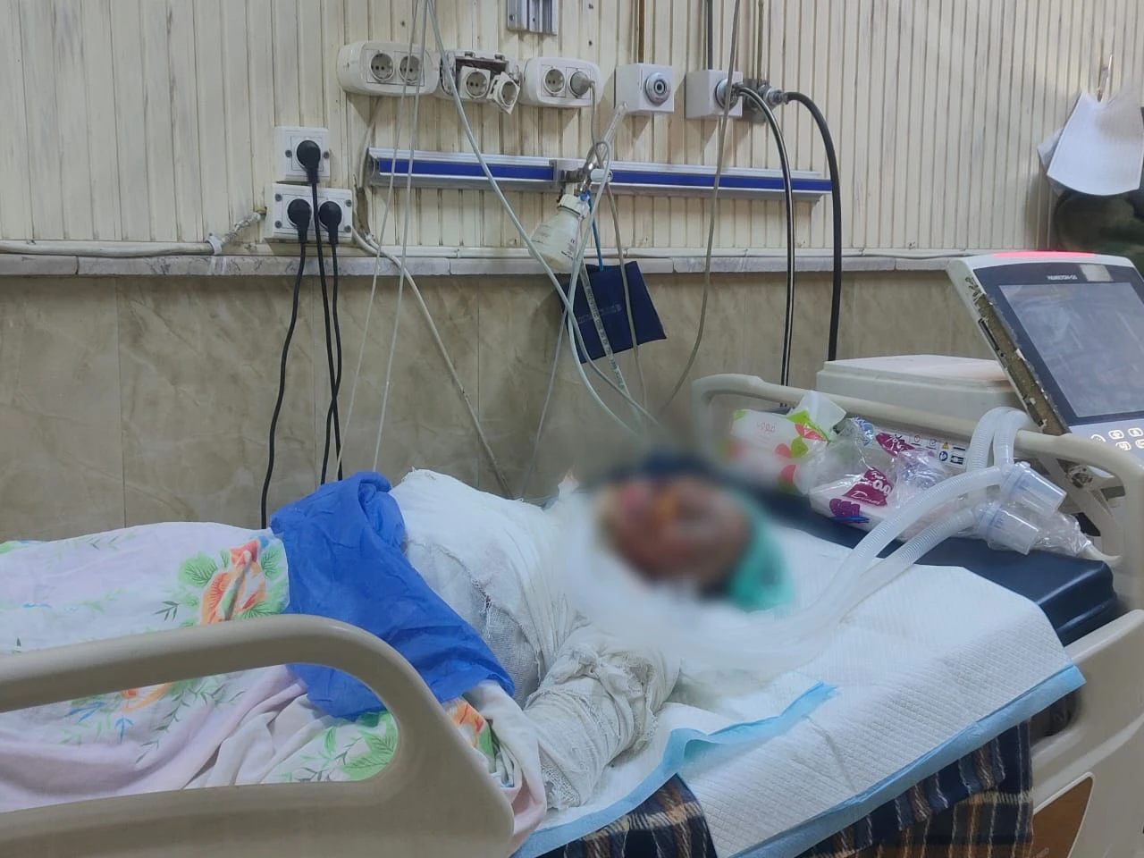 النيران تلتهم جسد شهد..